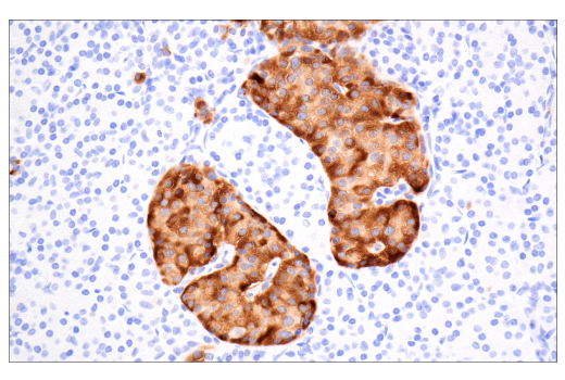 Immunohistochemistry Image 5: TIMP1 (D10E6) Rabbit mAb (BSA and Azide Free)