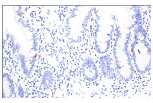 Immunohistochemistry Image 6: TIMP1 (D10E6) Rabbit mAb (BSA and Azide Free)