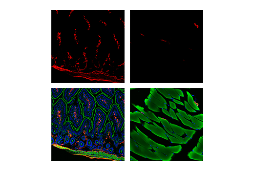 Immunofluorescence Image 1: α-Smooth Muscle Actin (D4K9N) XP® Rabbit mAb (Alexa Fluor® 647 Conjugate)