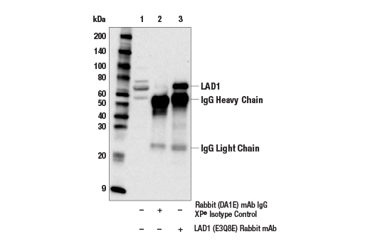 Immunoprecipitation Image 1: LAD1 (E3Q8E) Rabbit mAb