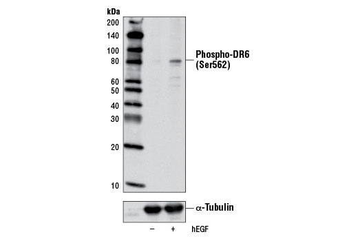 Western Blotting Image 1: Phospho-DR6 (Ser562) Antibody