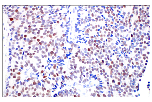 Immunohistochemistry Image 1: C/EBPβ (E2K1U) Rabbit mAb (BSA and Azide Free)