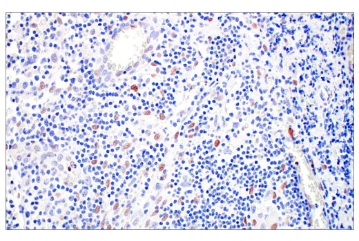 Immunohistochemistry Image 3: C/EBPβ (E2K1U) Rabbit mAb (BSA and Azide Free)