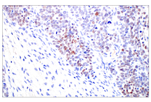 Immunohistochemistry Image 2: C/EBPβ (E2K1U) Rabbit mAb (BSA and Azide Free)