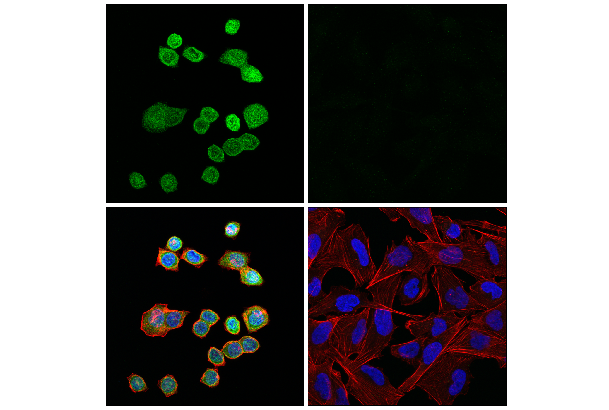 Immunofluorescence Image 1: UNC93B1 (E4W2T) Rabbit mAb