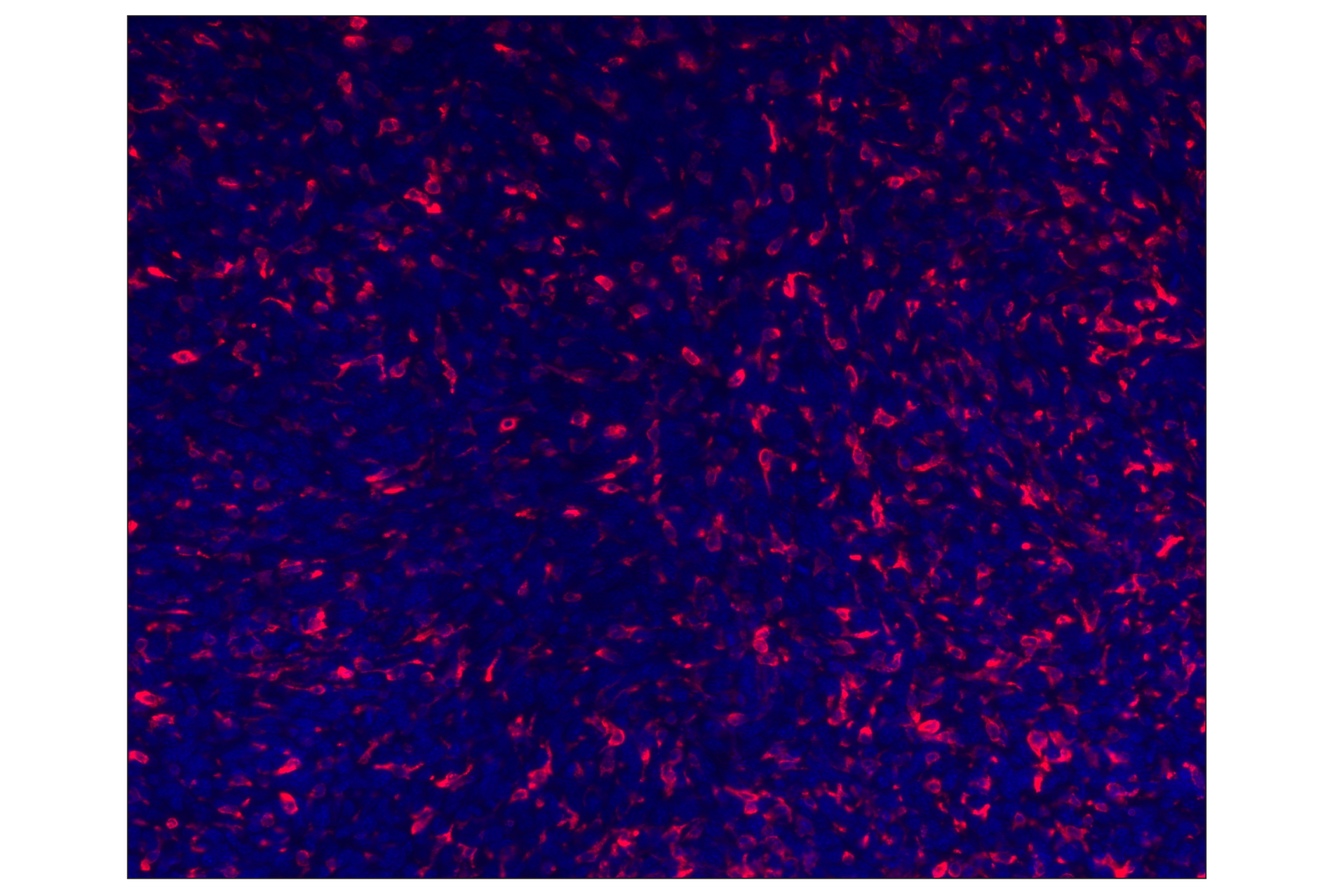 Immunohistochemistry Image 1: CD206/MRC1 (E6T5J) XP® Rabbit mAb (Alexa Fluor® 555 Conjugate)