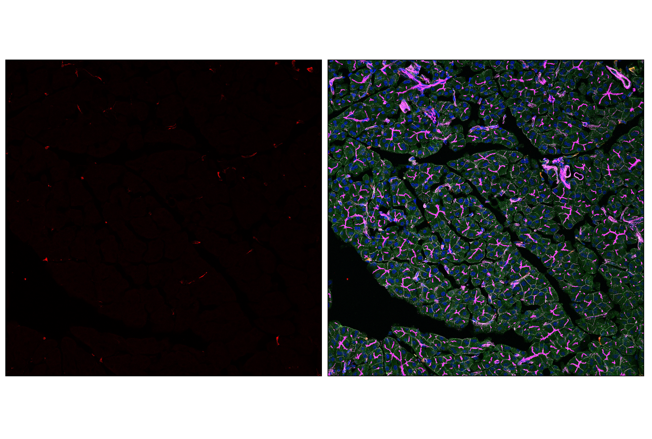 Immunofluorescence Image 2: CD206/MRC1 (E6T5J) XP® Rabbit mAb (Alexa Fluor® 555 Conjugate)