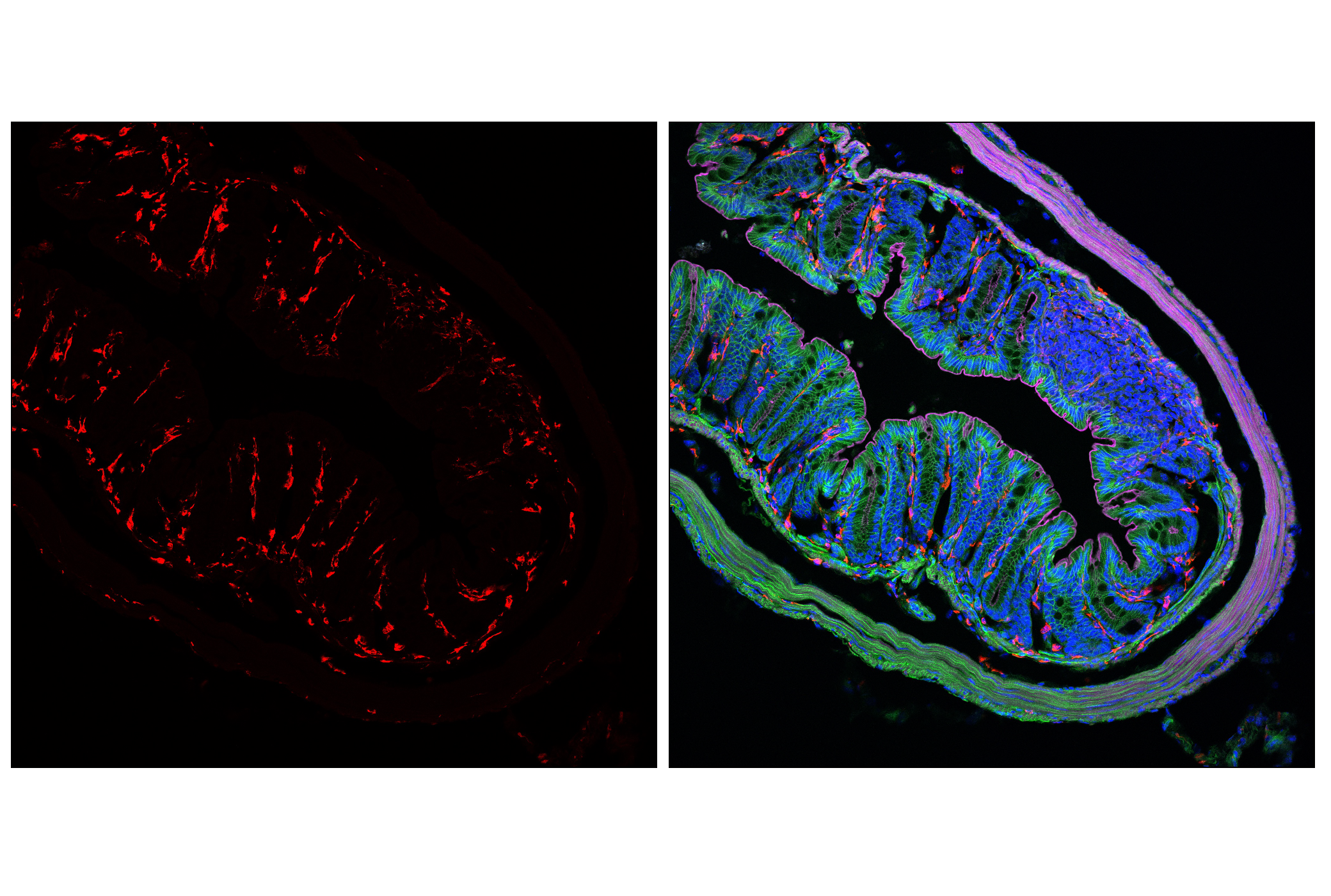 Immunofluorescence Image 1: CD206/MRC1 (E6T5J) XP® Rabbit mAb (Alexa Fluor® 555 Conjugate)