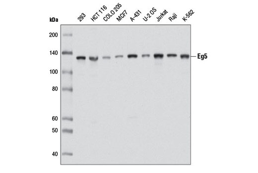 Western Blotting Image 1: Eg5 Antibody
