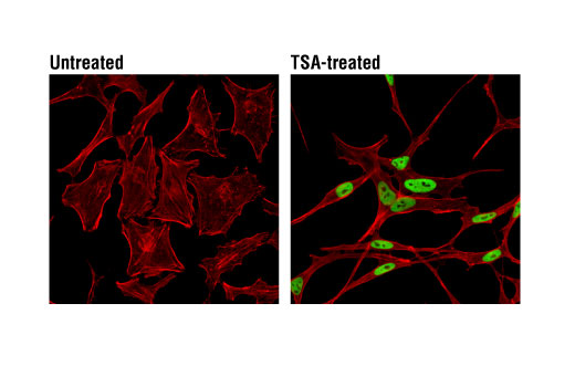 Immunofluorescence Image 1: Acetyl-Histone H3 (Lys14) (D4B9) Rabbit mAb