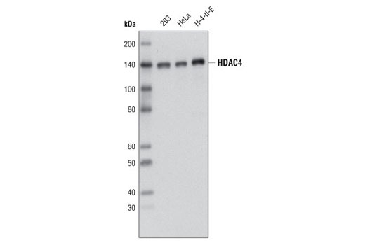  Image 9: Histone Deacetylase (HDAC) Antibody Sampler Kit