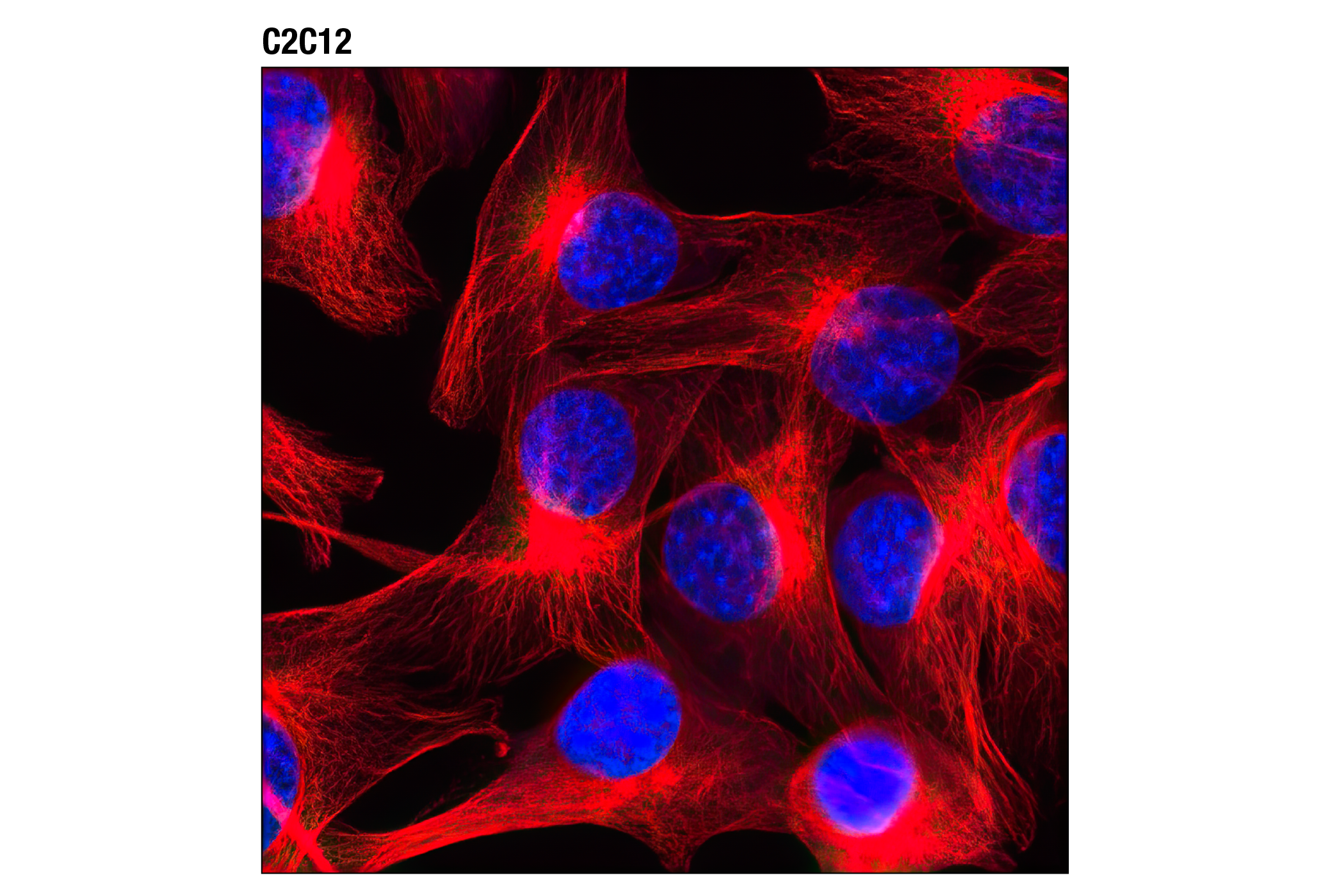 Immunofluorescence Image 1: β-Tubulin (9F3) Rabbit mAb (Alexa Fluor® 594 Conjugate)