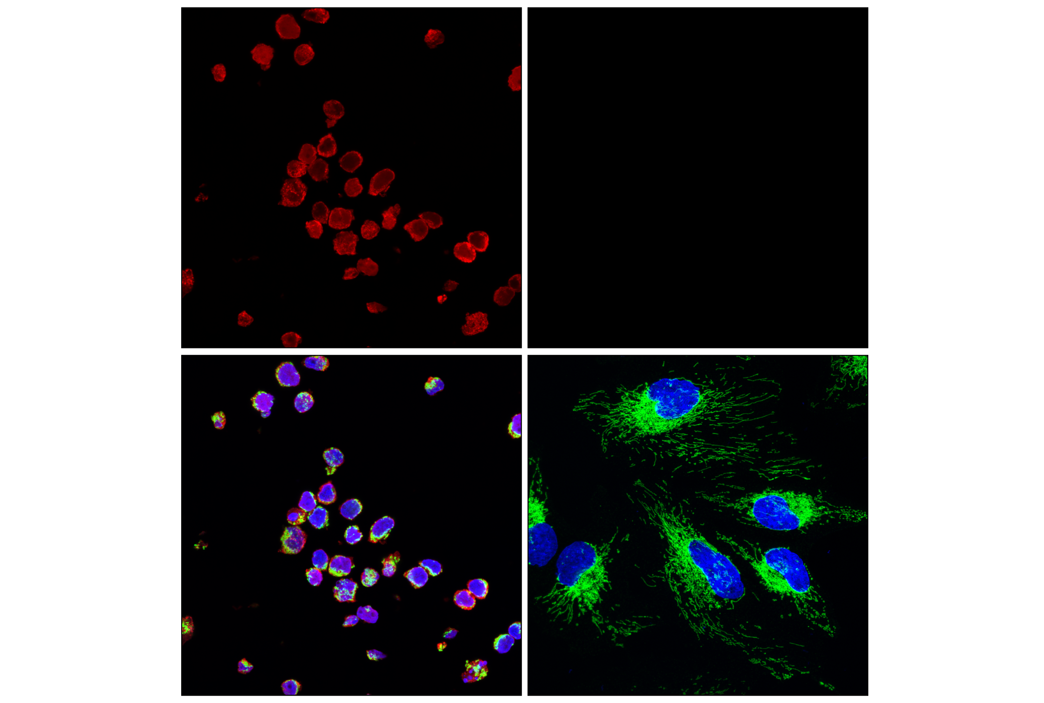 Immunofluorescence Image 1: Myeloperoxidase (E2Z8J) Rabbit mAb (Alexa Fluor® 647 Conjugate)