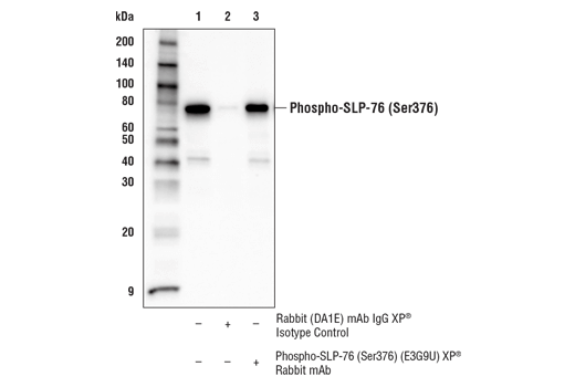 Immunoprecipitation Image 1: Phospho-SLP-76 (Ser376) (E3G9U) XP® Rabbit mAb