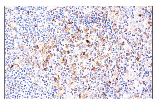 Immunohistochemistry Image 7: Phospho-SLP-76 (Ser376) (E3G9U) XP® Rabbit mAb