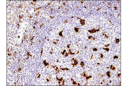  Image 5: Human Reactive M1 vs M2 Macrophage IHC Antibody Sampler Kit