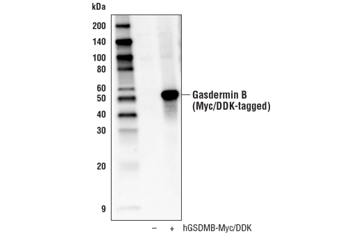 Western Blotting Image 1: Gasdermin B Antibody