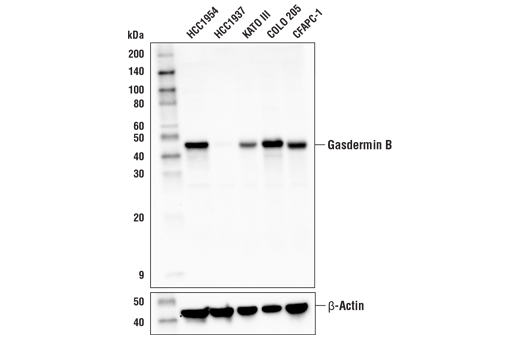 Western Blotting Image 2: Gasdermin B Antibody