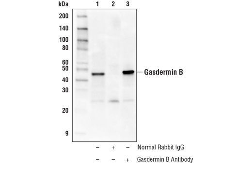 Immunoprecipitation Image 1: Gasdermin B Antibody