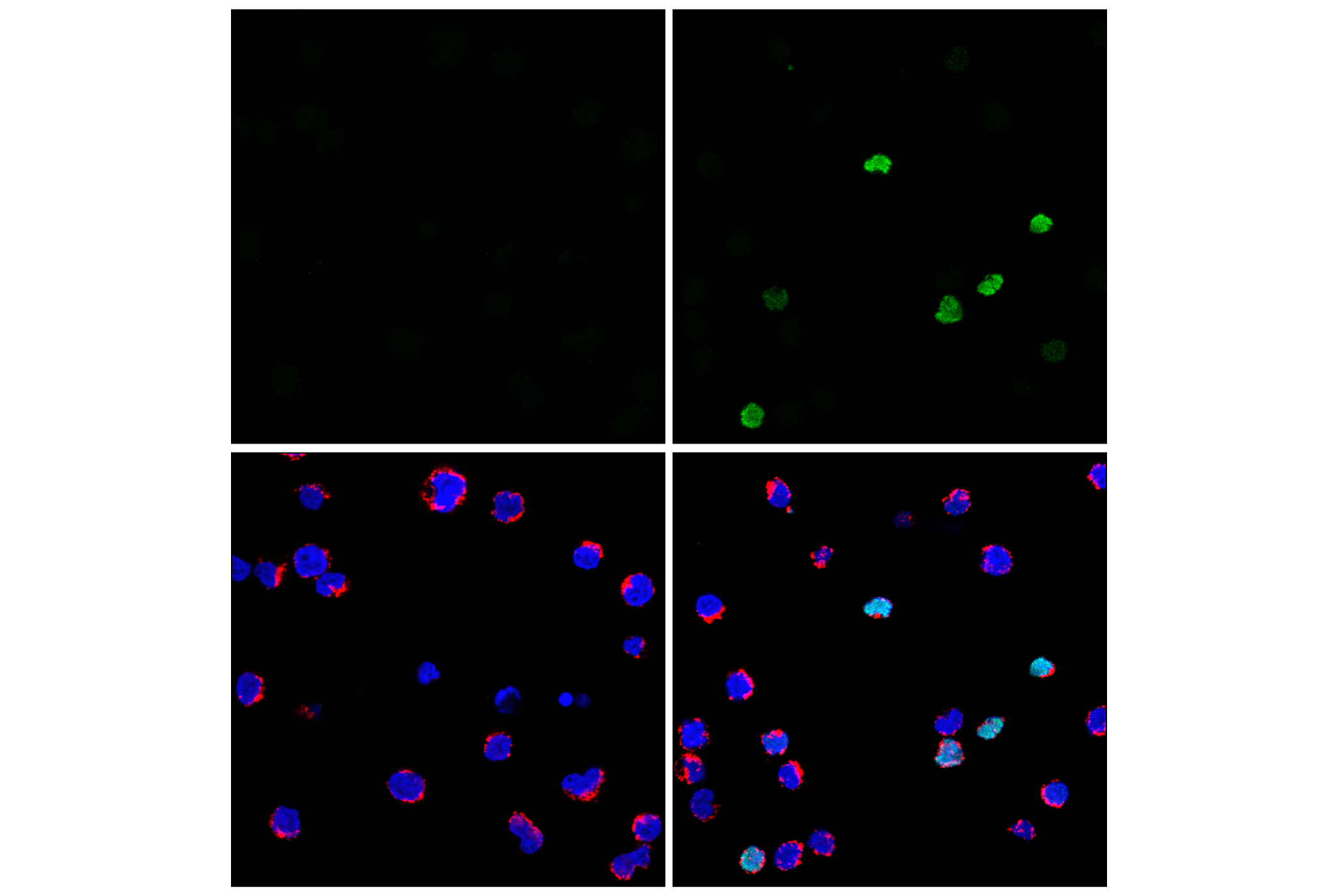 Immunofluorescence Image 1: PADI4 (F1B9L) Rabbit mAb