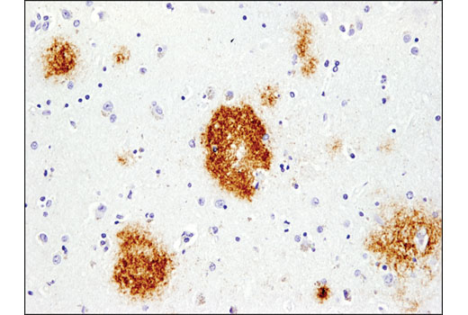 Immunohistochemistry Image 1: β-Amyloid (pE3 Peptide) (D5N5H) Rabbit mAb (BSA and Azide Free)