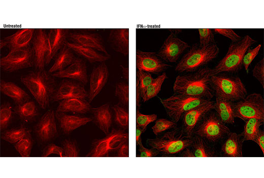  Image 11: Phospho-Stat Antibody Sampler Kit