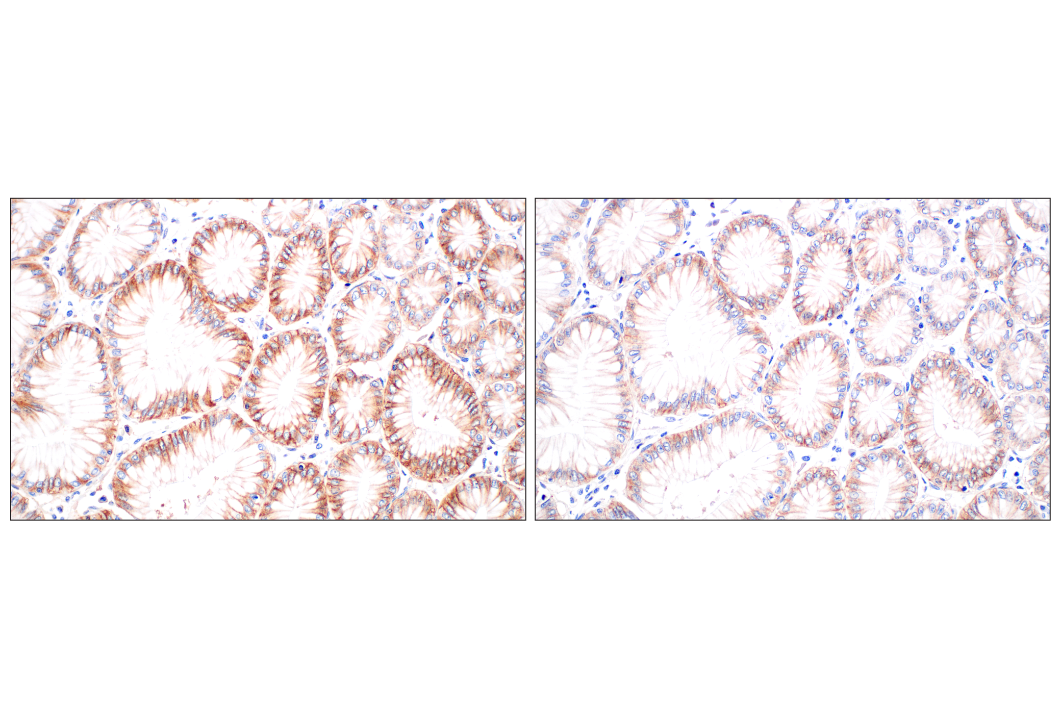Immunohistochemistry Image 8: MCT1/SLC16A1 (E7A2K) Rabbit mAb