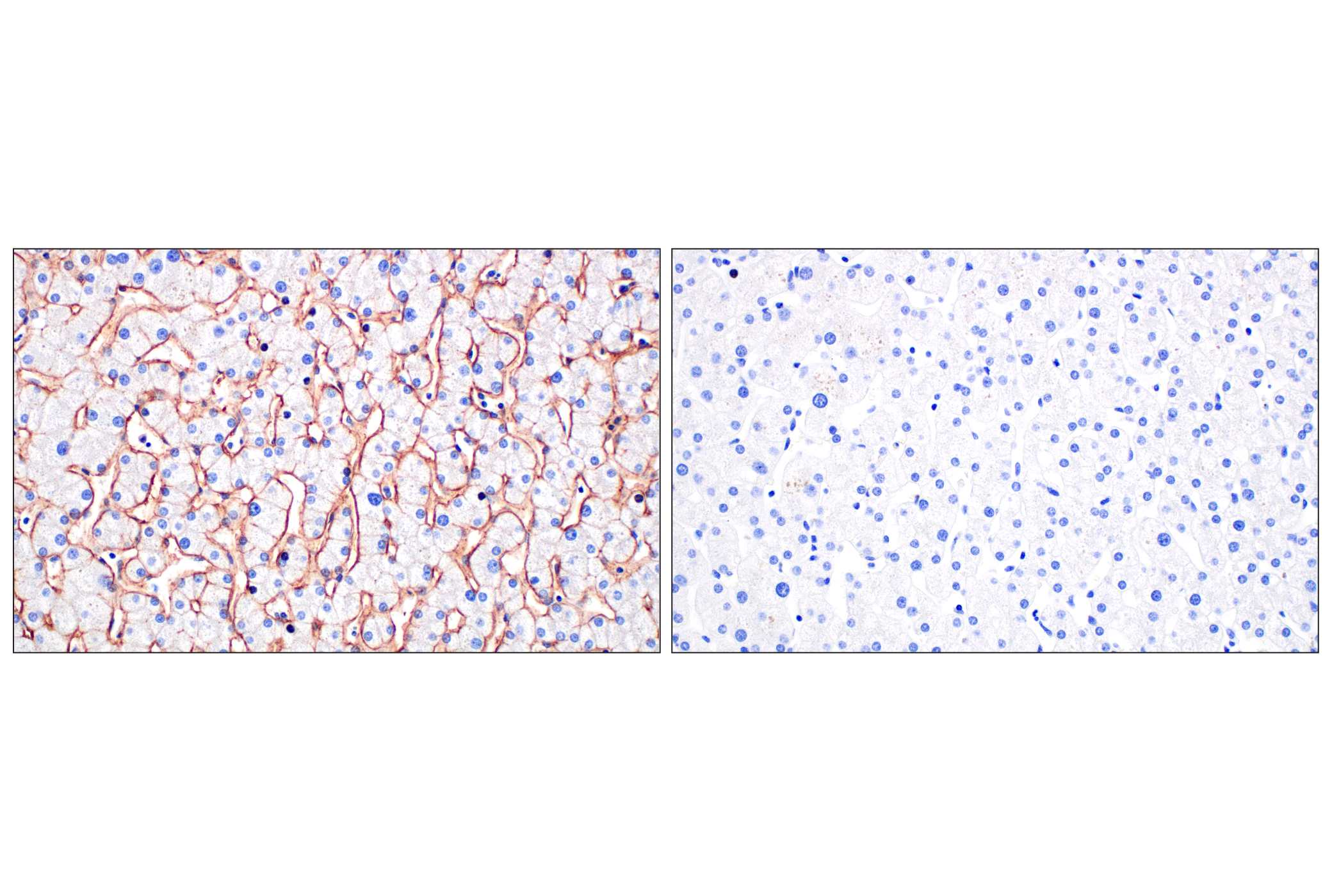 Immunohistochemistry Image 9: MCT1/SLC16A1 (E7A2K) Rabbit mAb