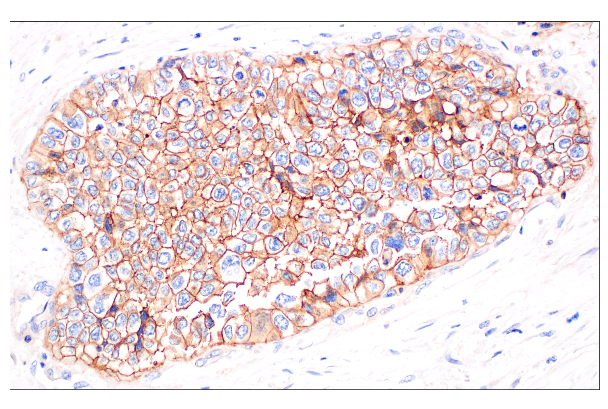 Immunohistochemistry Image 3: MCT1/SLC16A1 (E7A2K) Rabbit mAb