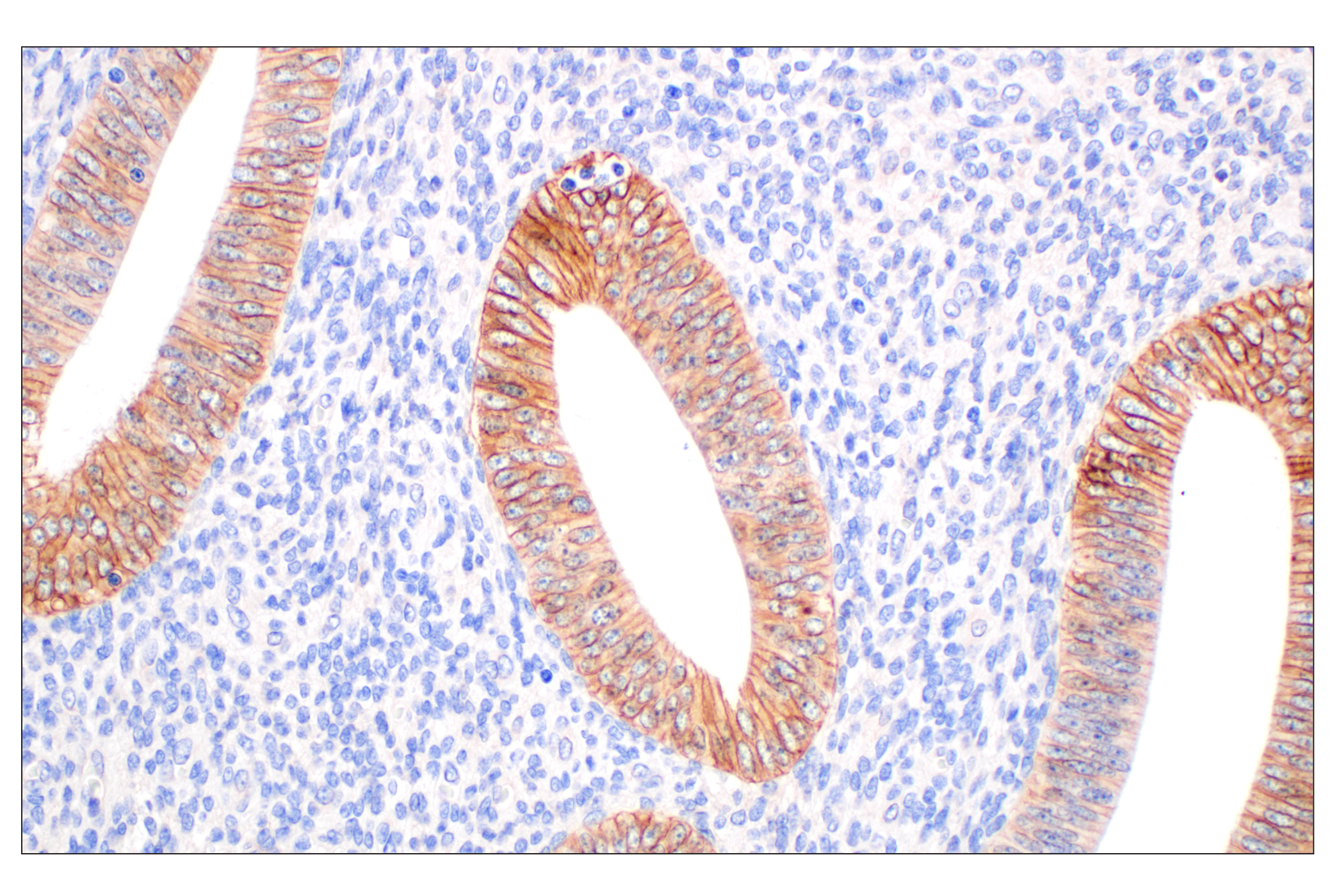 Immunohistochemistry Image 5: MCT1/SLC16A1 (E7A2K) Rabbit mAb