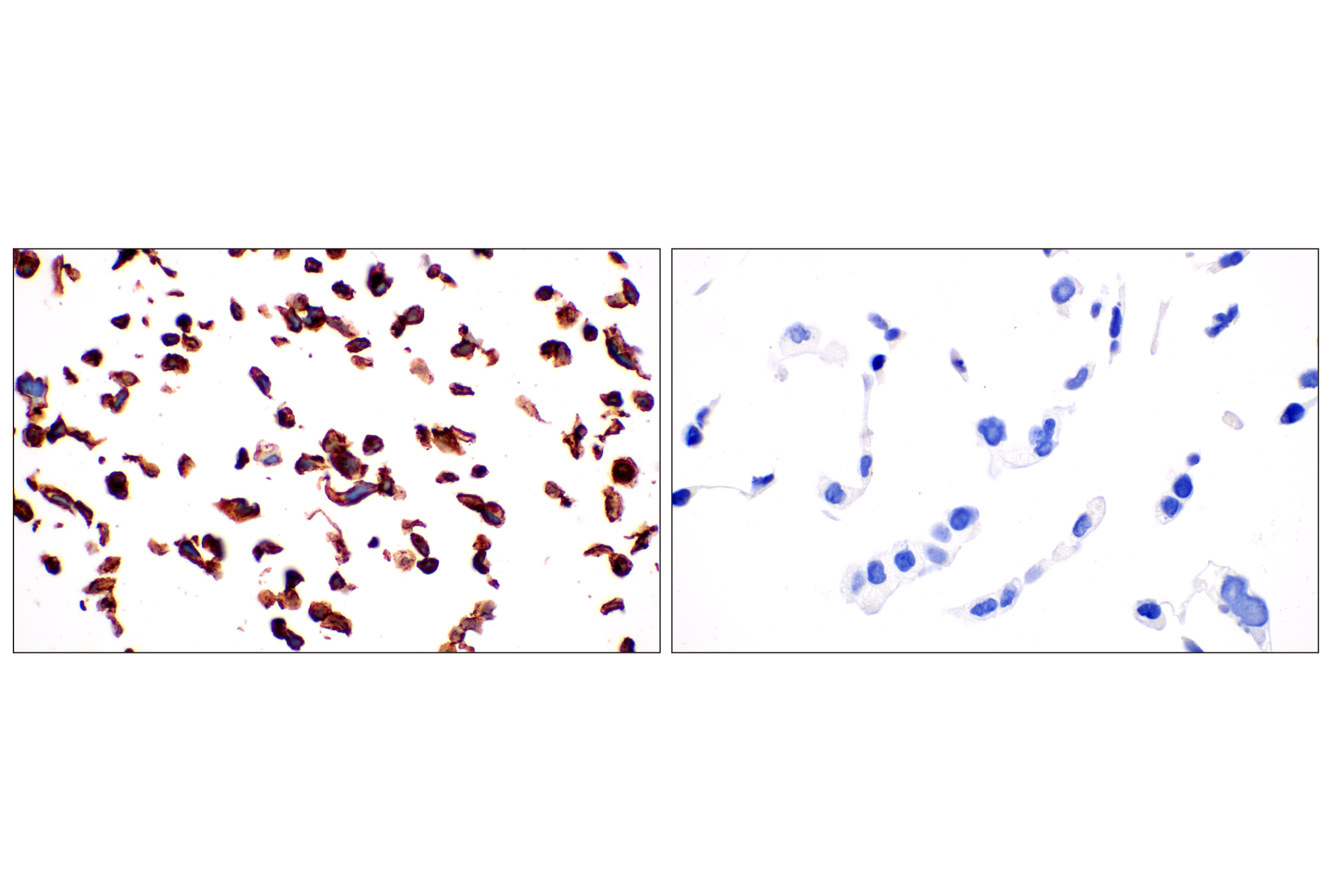 Immunohistochemistry Image 10: MCT1/SLC16A1 (E7A2K) Rabbit mAb
