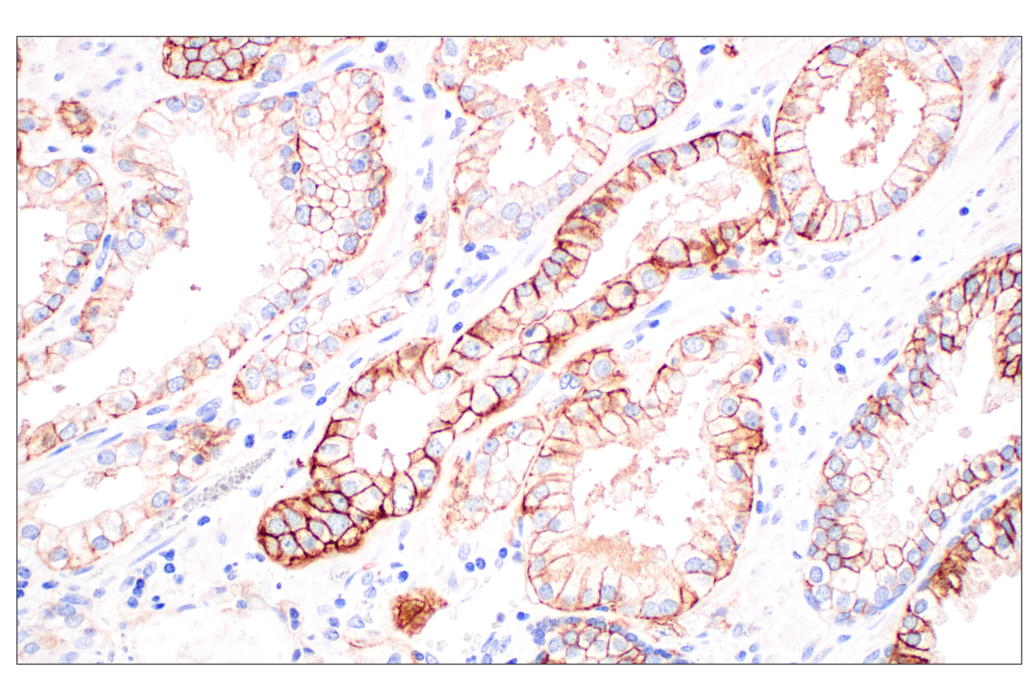 Immunohistochemistry Image 1: MCT1/SLC16A1 (E7A2K) Rabbit mAb
