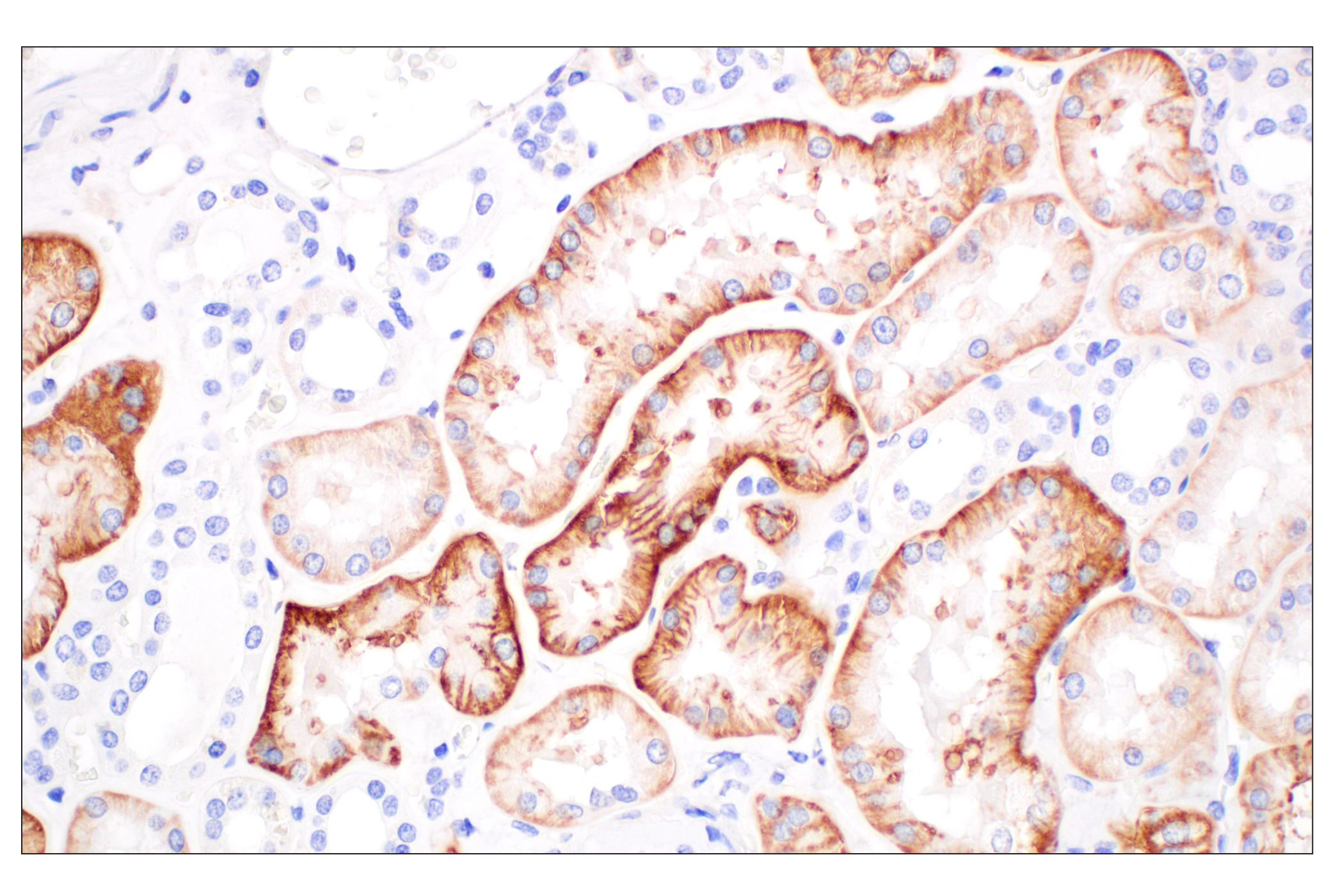 Immunohistochemistry Image 7: MCT1/SLC16A1 (E7A2K) Rabbit mAb