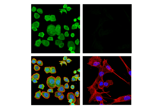 Immunofluorescence Image 1: GRB7 (E3W4G) Rabbit mAb