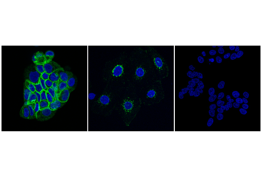 Immunofluorescence Image 1: IGFBP5 (E3H3Z) Rabbit mAb