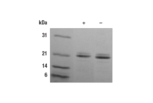  Image 2: Mouse IL-11 Recombinant Protein