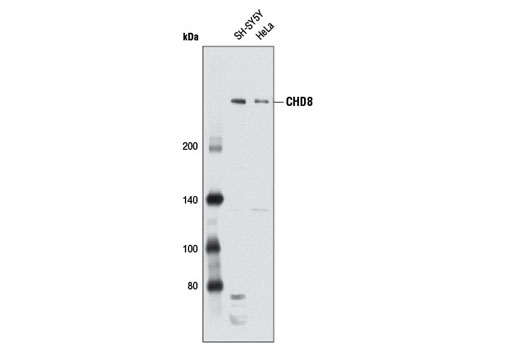 Western Blotting Image 1: CHD8 Antibody