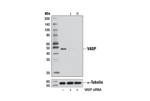  Image 1: SignalSilence® VASP siRNA II