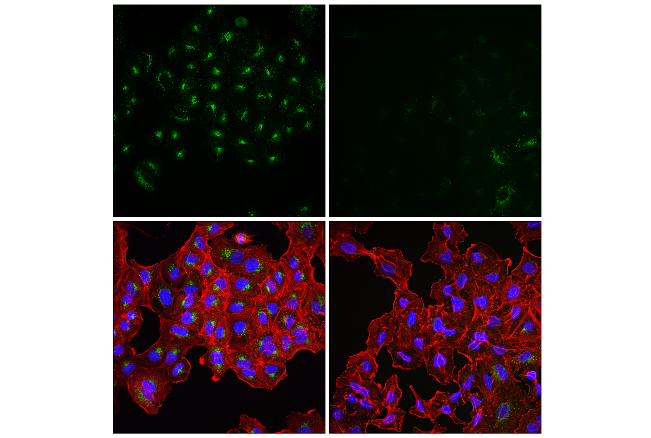 Immunofluorescence Image 3: APP (E4H1U) Rabbit mAb