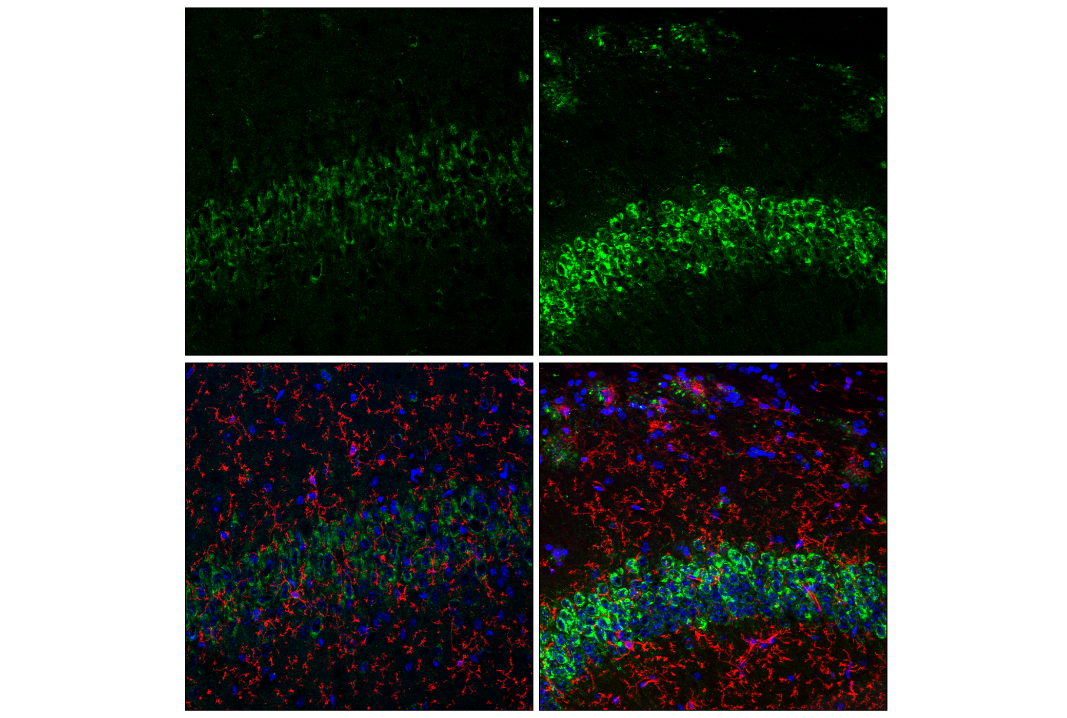 Immunofluorescence Image 1: APP (E4H1U) Rabbit mAb
