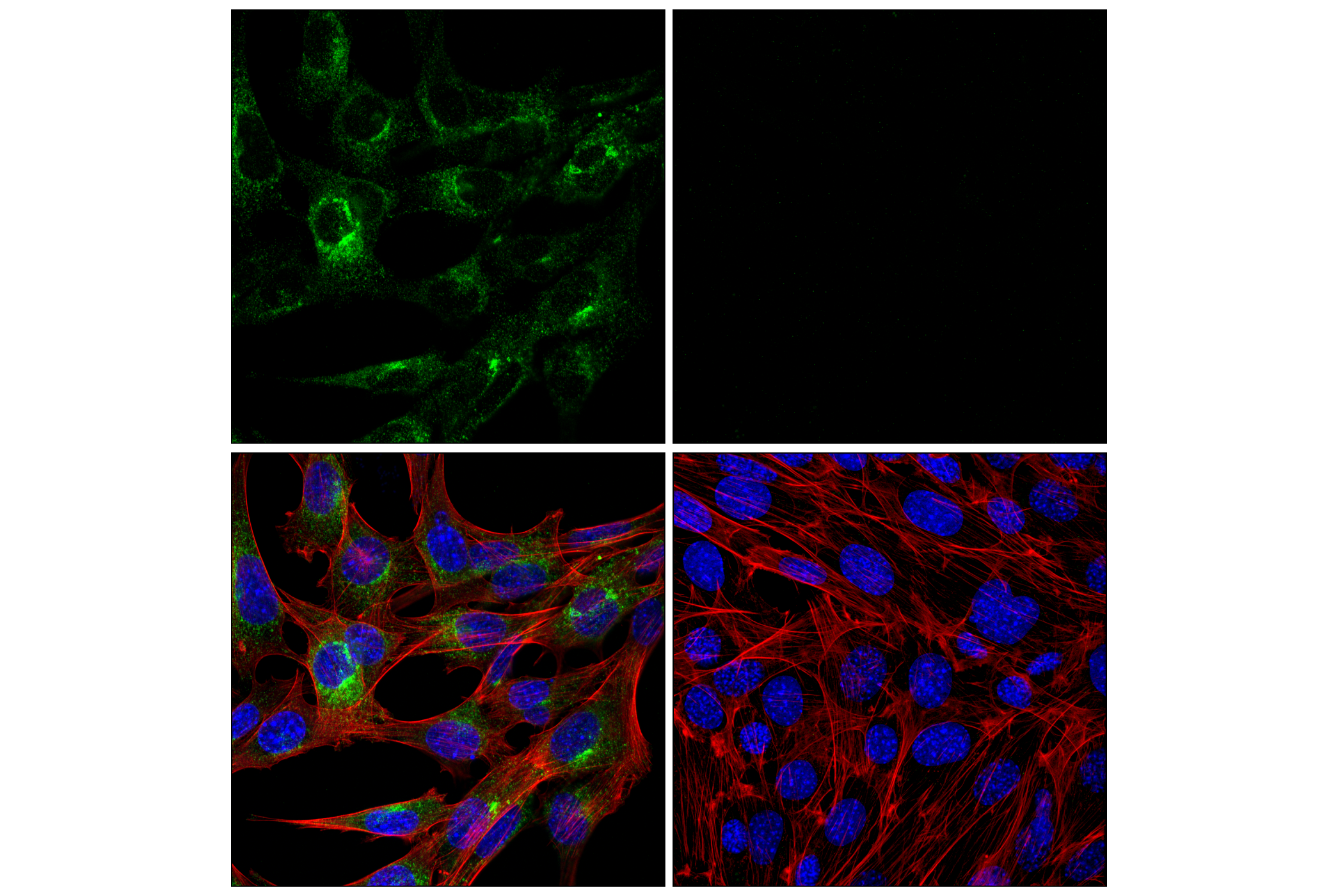 Immunofluorescence Image 2: APP (E4H1U) Rabbit mAb