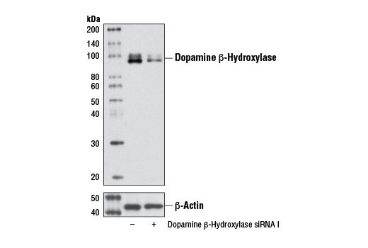  Image 1: SignalSilence® Dopamine β-Hydroxylase (DBH) siRNA I