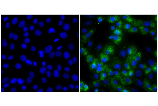 Immunofluorescence Image 1: dsRNA (J2) Mouse mAb