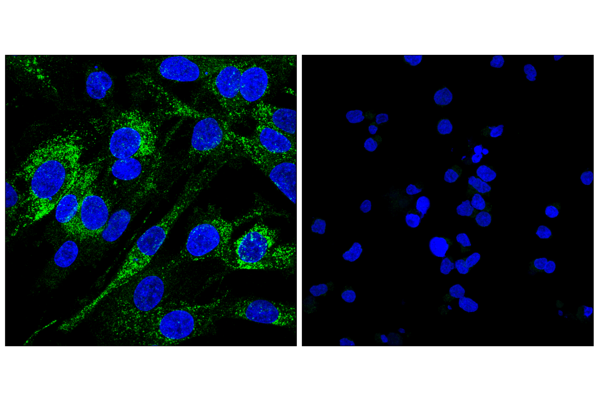 Immunofluorescence Image 1: GP130 (E6X8S) Rabbit mAb