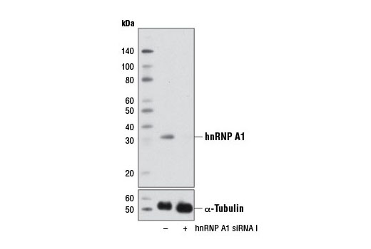  Image 1: SignalSilence® hnRNP A1 siRNA I