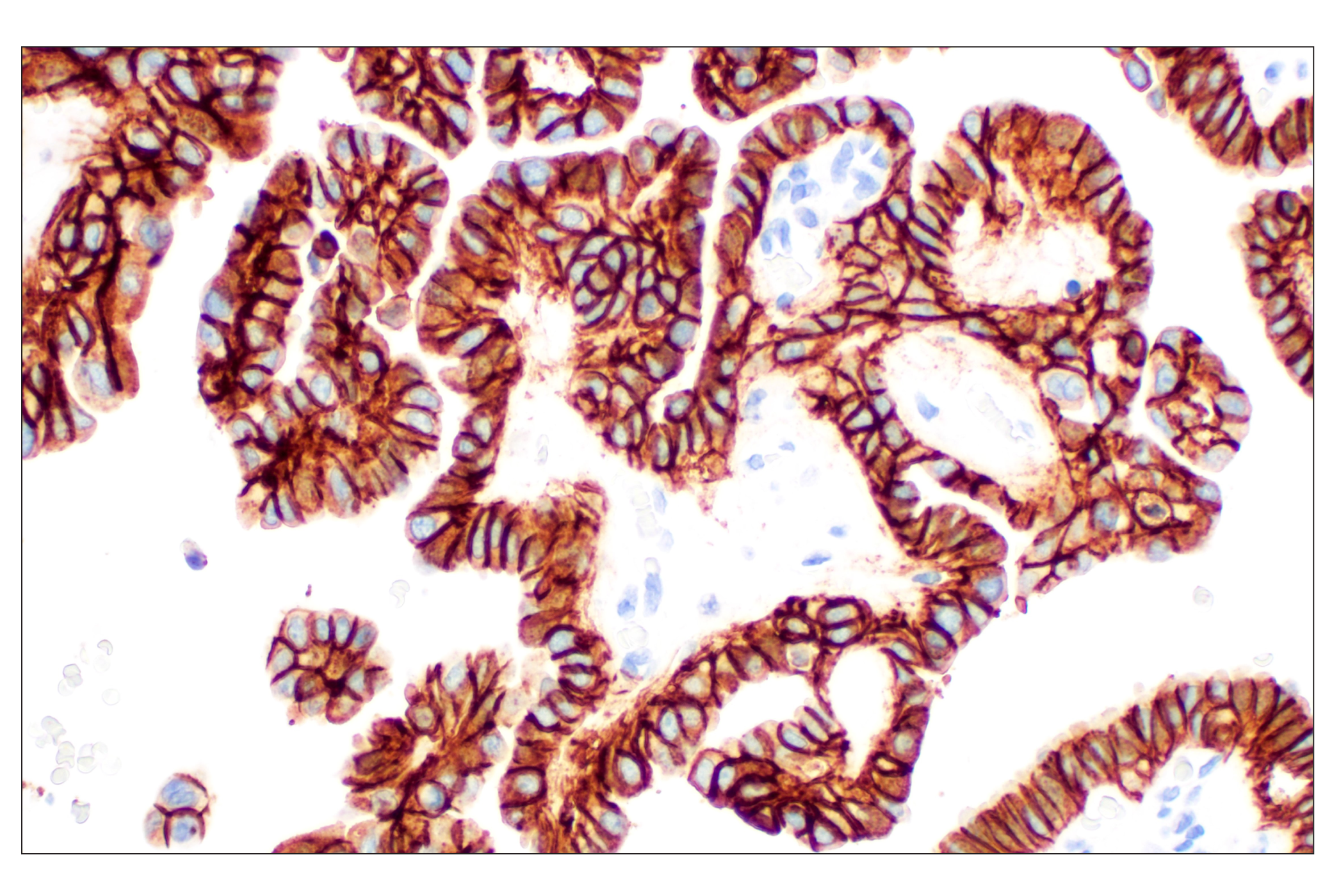 Immunohistochemistry Image 2: TACSTD2/TROP2 (F4W4J) Rabbit mAb