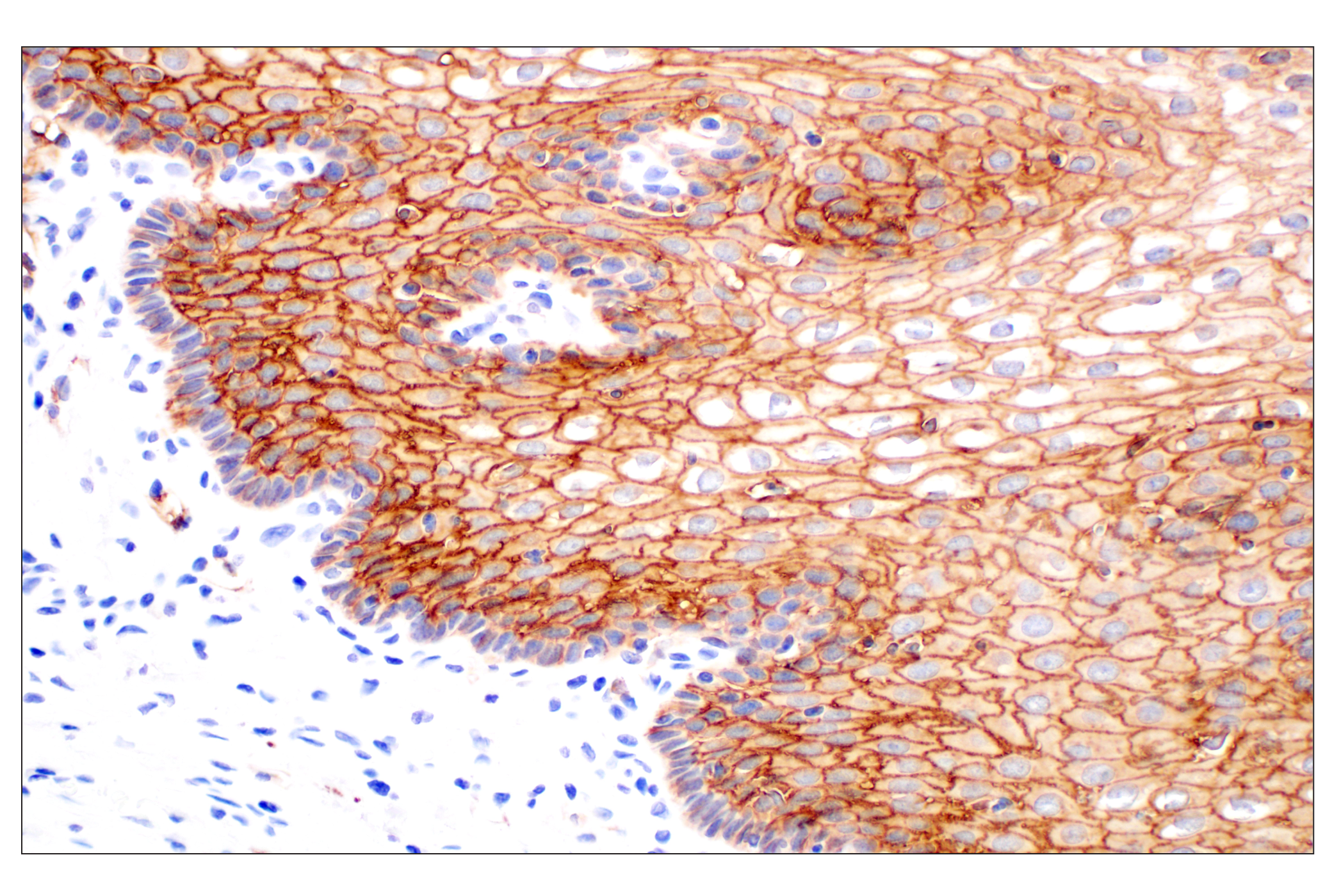 Immunohistochemistry Image 8: TACSTD2/TROP2 (F4W4J) Rabbit mAb