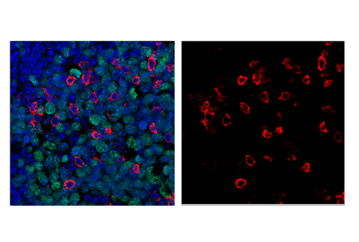 Immunofluorescence Image 1: PD-1 (Intracellular Domain) (D7D5W) XP® Rabbit mAb (Alexa Fluor® 555 Conjugate)