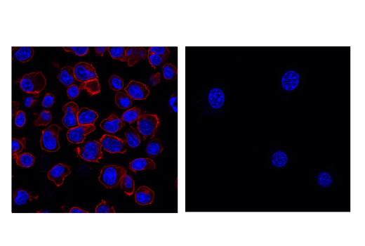 Immunofluorescence Image 2: PD-1 (Intracellular Domain) (D7D5W) XP® Rabbit mAb (Alexa Fluor® 555 Conjugate)