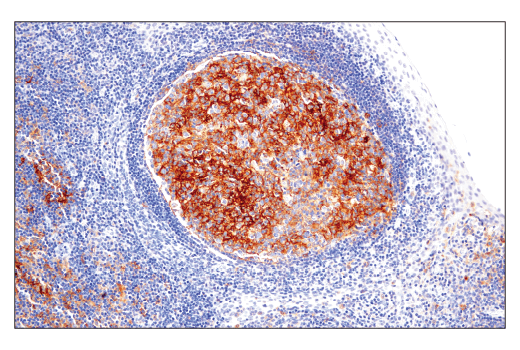 Immunohistochemistry Image 1: CD86 (E2G8P) Rabbit mAb (BSA and Azide Free)